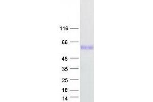 Validation with Western Blot