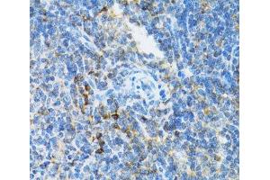 Immunohistochemistry of paraffin-embedded Mouse spleen using UBE2D1 Polyclonal Antibody at dilution of 1:100 (40x lens). (UBE2D1 antibody)