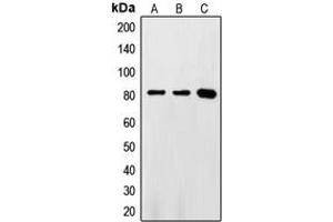 Western blot analysis of FASTKD2 expression in HeLa (A), Jurkat (B), Ramos (C) whole cell lysates. (FASTKD2 antibody  (Center))