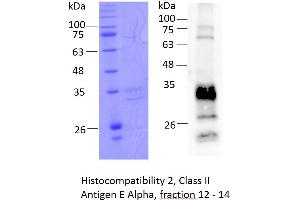 Image no. 2 for Histocompatibility 2, Class II Antigen E Alpha, Pseudogene (H2-EA-PS) (AA 26-255) protein (rho-1D4 tag) (ABIN3132417) (Histocompatibility 2, Class II Antigen E Alpha, Pseudogene (H2-EA-PS) (AA 26-255) protein (rho-1D4 tag))
