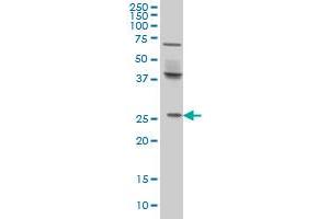 Western Blotting (WB) image for anti-PRELI Domain Containing 1 (PRELID1) (AA 3-100) antibody (ABIN7477824)