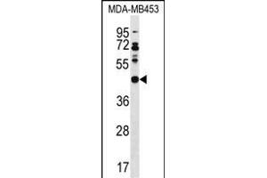 DNAJB5 antibody  (C-Term)