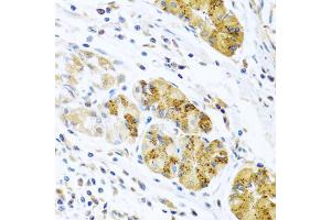 Immunohistochemistry of paraffin-embedded human stomach using CCL8 antibody (ABIN5975074) at dilution of 1/100 (40x lens). (CCL8 antibody)