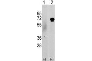 Western blot analysis of CAMKK2 antibody and 293 cell lysate either nontransfected (c) or transiently transfected with the CAMKK2 gene (2). (CAMKK2 antibody  (AA 52-82))