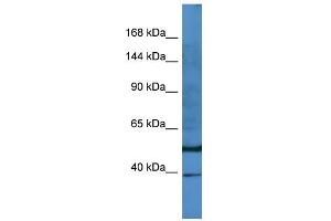 Host:  Rabbit  Target Name:  E2F8  Sample Type:  PANC1 Whole Cell lysates  Antibody Dilution:  1. (E2F8 antibody  (N-Term))