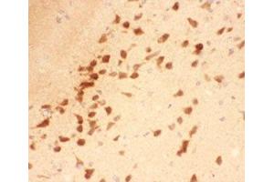 IHC-P testing of rat brain tissue (BDNF antibody  (AA 129-247))