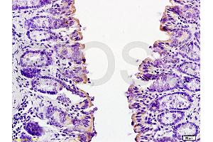 Formalin-fixed and paraffin embedded mouse small intestine tissue labeled with Anti-CCL24 Polyclonal Antibody, Unconjugated (ABIN740925) at 1:200 followed by conjugation to the secondary antibody and DAB staining (CCL24 antibody  (AA 27-119))