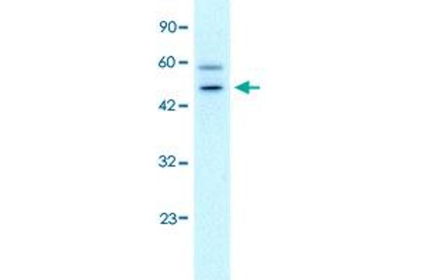GC-Rich Promoter Binding Protein 1 (GPBP1) (N-Term) antibody