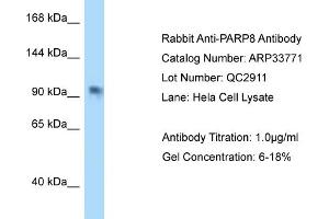 WB Suggested Anti-PAntibody   Titration: 1. (PARP8 antibody  (C-Term))