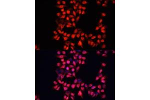 Immunofluorescence analysis of HeLa cells using  antibody (ABIN6129173, ABIN6136519, ABIN6136520 and ABIN6214691) at dilution of 1:100. (ADAM10 antibody  (AA 214-500))