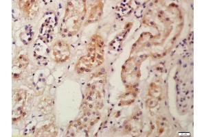 Formalin-fixed and paraffin embedded human kidney labeled with Anti-Frizzled 9/CD349 Polyclonal Antibody, Unconjugated (ABIN1386280) at 1:200 followed by conjugation to the secondary antibody and DAB staining (FZD9 antibody  (AA 185-270))