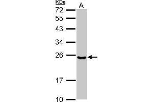 WB Image Sample (30 ug of whole cell lysate) A: NT2D1 12% SDS PAGE antibody diluted at 1:1000 (Ube2t antibody  (C-Term))