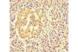 Immunohistochemistry of paraffin-embedded human pancreatic tissue using ABIN7158700 at dilution of 1:100 (KDM4C antibody  (AA 450-600))