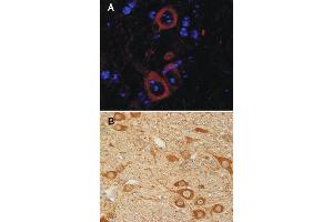 A: Indirect immunostaining of PFA fixed mouse cortex sections (dilution 1 : 5000; red). (ENO2/NSE antibody  (AA 418-434))