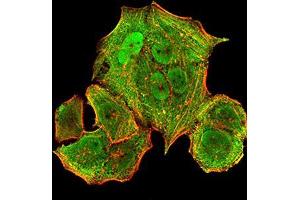 Immunocytochemistry (ICC) image for anti-Major Histocompatibility Complex, Class I, B (HLA-B) (AA 241-362) antibody (ABIN5542338)
