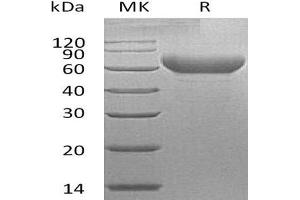 Western Blotting (WB) image for Hepatitis A Virus Cellular Receptor 2 (TIM 3) protein (Fc Tag) (ABIN7320954) (TIM3 Protein (Fc Tag))