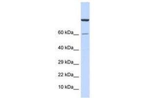 Image no. 1 for anti-Zinc Finger Protein 251 (ZNF251) (AA 91-140) antibody (ABIN6740522)