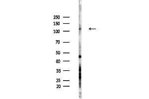 Western blot analysis of lysates from LoVo cells(heat-shock,45 min treatment), using GRIP1 Antibody at 1/1000 dilution.