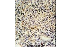 CORO6 Antibody (Center) (ABIN651025 and ABIN2840041) immunohistochemistry analysis in formalin fixed and paraffin embedded human lymph tissue followed by peroxidase conjugation of the secondary antibody and DAB staining. (Coronin 6 antibody  (AA 196-224))