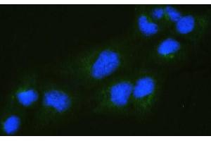 anti-RalA Binding Protein 1 (RALBP1) (AA 239-506) antibody