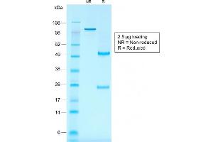 SDS-PAGE Analysis Purified CD30 Mouse Recombinant Monoclonal Antibody (rKi-1/779). (Recombinant TNFRSF8 antibody)