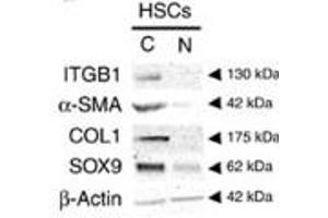 Activated mouse HSCs (‘Control') show decreased protein levels for α-SMA, COL1 and SOX9 by immunoblotting following the loss of integrin beta-1 (‘Itgb1-null').