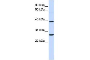 WNT16 antibody used at 1 ug/ml to detect target protein.