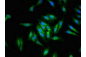 Immunofluorescent analysis of Hela cells using ABIN7151013 at dilution of 1:100 and Alexa Fluor 488-congugated AffiniPure Goat Anti-Rabbit IgG(H+L) (Deltex Homolog 1 antibody  (AA 261-410))
