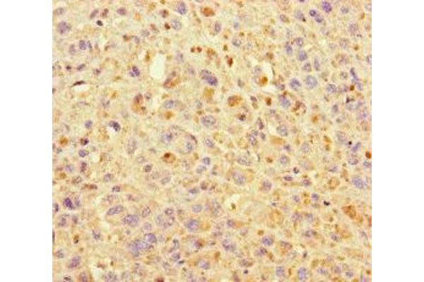 KIF24 antibody  (AA 1168-1368)