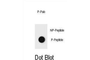 Dot blot analysis of Phospho-PTEN- Antibody Phospho-specific Pab (ABIN6241052 and ABIN6578937) on nitrocellulose membrane. (PTEN antibody  (pThr382))
