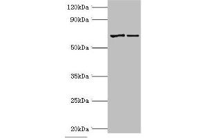 Western blot All lanes: Myotubularin antibody at 2 μg/mL Lane 1: Jurkat whole cell lysate Lane 2: HepG2 whole cell lysate Secondary Goat polyclonal to rabbit IgG at 1/10000 dilution Predicted band size: 70, 67 kDa Observed band size: 70 kDa (MTM1 antibody  (AA 484-603))