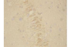 Immunohistochemistry (Formalin/PFA-fixed paraffin-embedded sections) of rat brain tissue with PSEN2 polyclonal antibody . (Presenilin 2 antibody  (Internal Region))