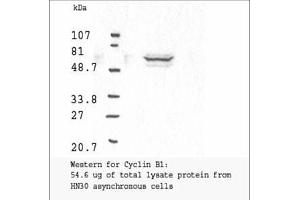 Image no. 3 for anti-Cyclin B1 (CCNB1) antibody (ABIN599627) (Cyclin B1 antibody)