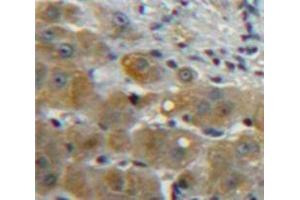 IHC-P analysis of Liver tissue, with DAB staining. (CCL5 antibody  (AA 24-91))