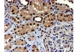 Immunohistochemical staining of paraffin-embedded Human Kidney tissue using anti-TOMM34 mouse monoclonal antibody.