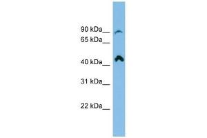 RP11-298P3. (RP11-298P3.3 (N-Term) antibody)