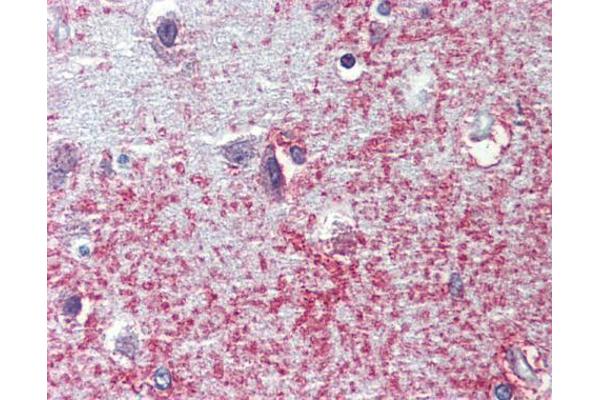 SHROOM2 antibody  (C-Term)