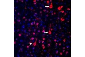 Expression of GPR17 in rat parietal cortex - Immunohistochemical staining of perfusion-fixed frozen rat brain sections with Anti-GPR17 Antibody (ABIN7043149, ABIN7044435 and ABIN7044436), (1:300), followed by donkey-anti-rabbit-biotin and streptavidin-Cy3. (GPR17 antibody  (Intracellular))
