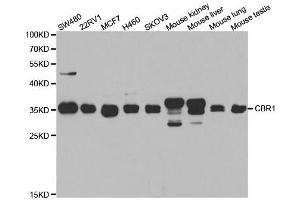 Western blot analysis of extracts of various cell lines, using CBR1 antibody. (CBR1 antibody  (AA 1-277))