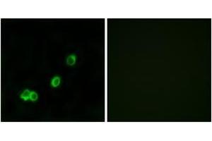 Immunofluorescence analysis of MCF7 cells, using ACOT1 Antibody. (ACOT1 antibody  (AA 91-140))