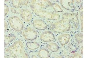 Immunohistochemistry (IHC) image for anti-Apolipoprotein L, 1 (APOL1) (AA 179-398) antibody (ABIN7144436)
