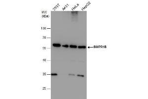 WB Image BMPR1B antibody detects BMPR1B protein by western blot analysis. (BMPR1B antibody)