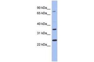 Image no. 1 for anti-Zinc Finger Protein 133 (ZNF133) (N-Term) antibody (ABIN6742760) (ZNF133 antibody  (N-Term))