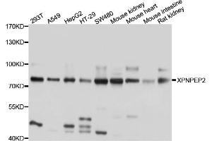 Western blot analysis of extracts of various cell lines, using XPNPEP2 antibody. (XPNPEP2 antibody)