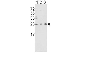 Western Blotting (WB) image for anti-Triosephosphate Isomerase 1 (TPI1) antibody (ABIN3001712) (TPI1 antibody)