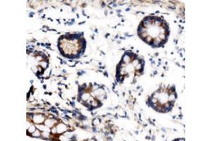 IHC analysis of VPRBP/DCAF1 using anti-VPRBP/DCAF1 antibody (ABIN7602005). (DDB1 and CUL4-Associated Factor 1 (DCAF1) (AA 540-861) antibody)