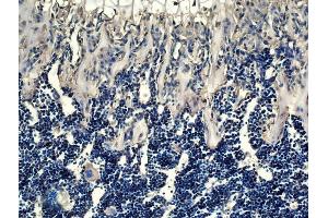 Immunohistochemistry (IHC) image for anti-Tumor Necrosis Factor (Ligand) Superfamily, Member 11 (TNFSF11) (AA 221-300) antibody (ABIN668556)