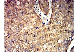 Immunohistochemistry (IHC) image for anti-Aldolase A, Fructose-Bisphosphate (ALDOA) (AA 9-145) antibody (ABIN5611221)