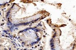 Immunohistochemistry analysis of paraffin-embedded human para-cancer stomach using SYTL2 (ABIN7075797) at dilution of 1: 1600