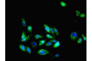 Immunofluorescent analysis of Hela cells cells using ABIN7153143 at dilution of 1:100 and Alexa Fluor 488-congugated AffiniPure Goat Anti-Rabbit IgG(H+L) (CX3CL1 antibody  (AA 25-100))